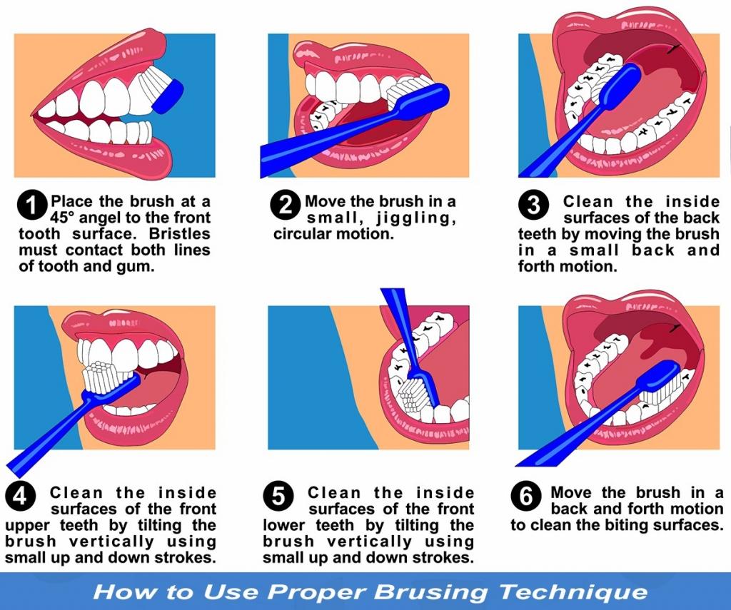 Correct brushing technique 1